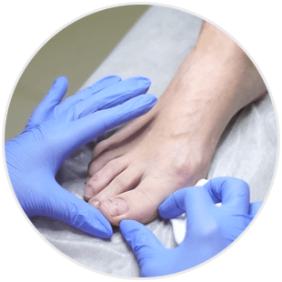 Zabieg podologiczny