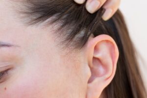 Łojotokowe zapalenie skóry za uszami